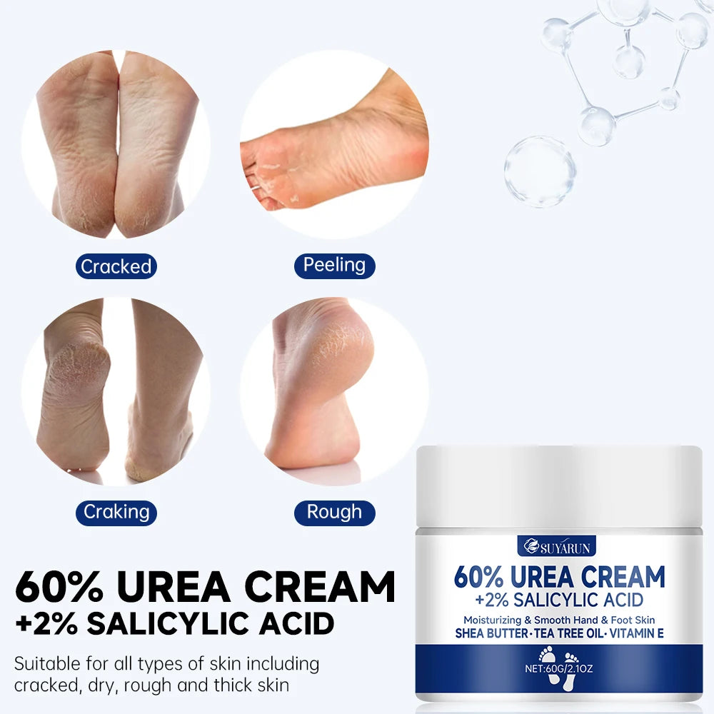 SUYARUN 60% Urea Foot Cream — Intensive Cracked Heel & Dry Skin Treatment, Diabetic Foot Care